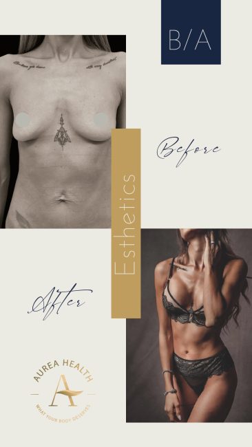 Aurea_Stories_BA-01