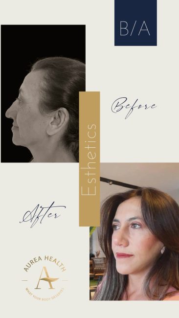 Aurea_Stories_BA-03