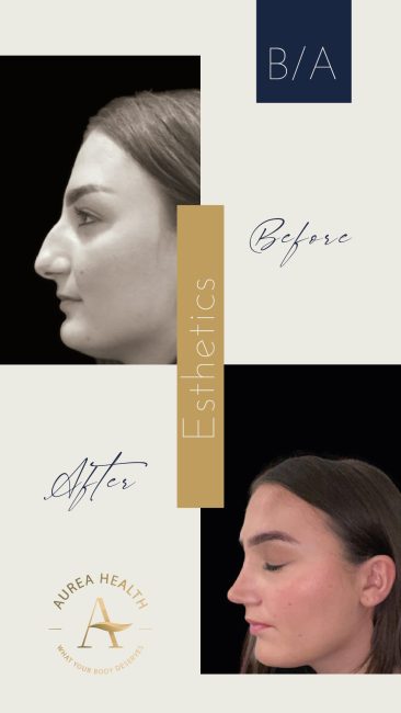 Aurea_Stories_BA-07