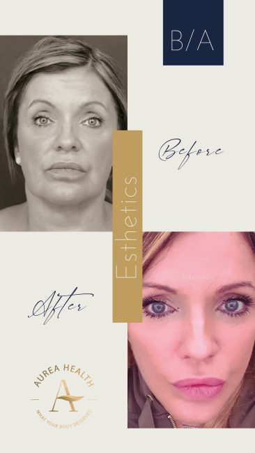 Aurea_Stories_BA-09