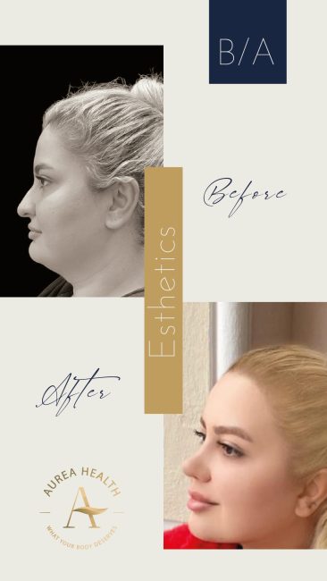 Aurea_Stories_BA-10